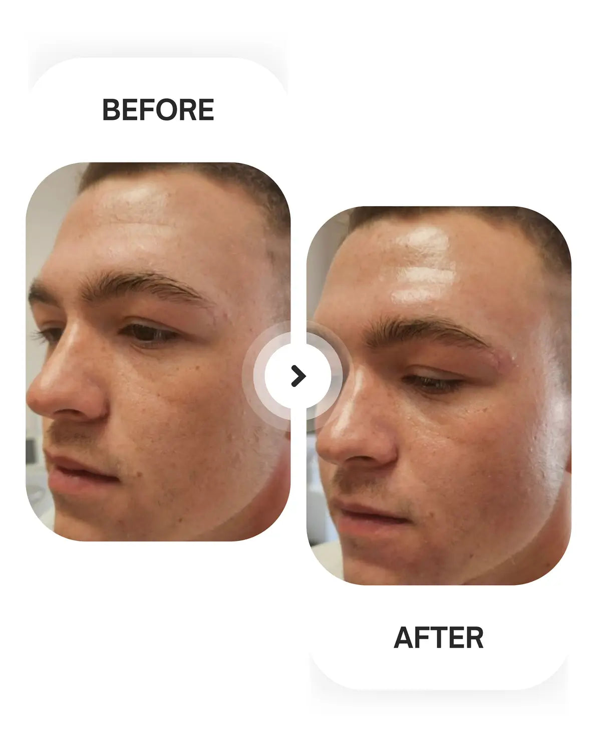 before and after face serum mens